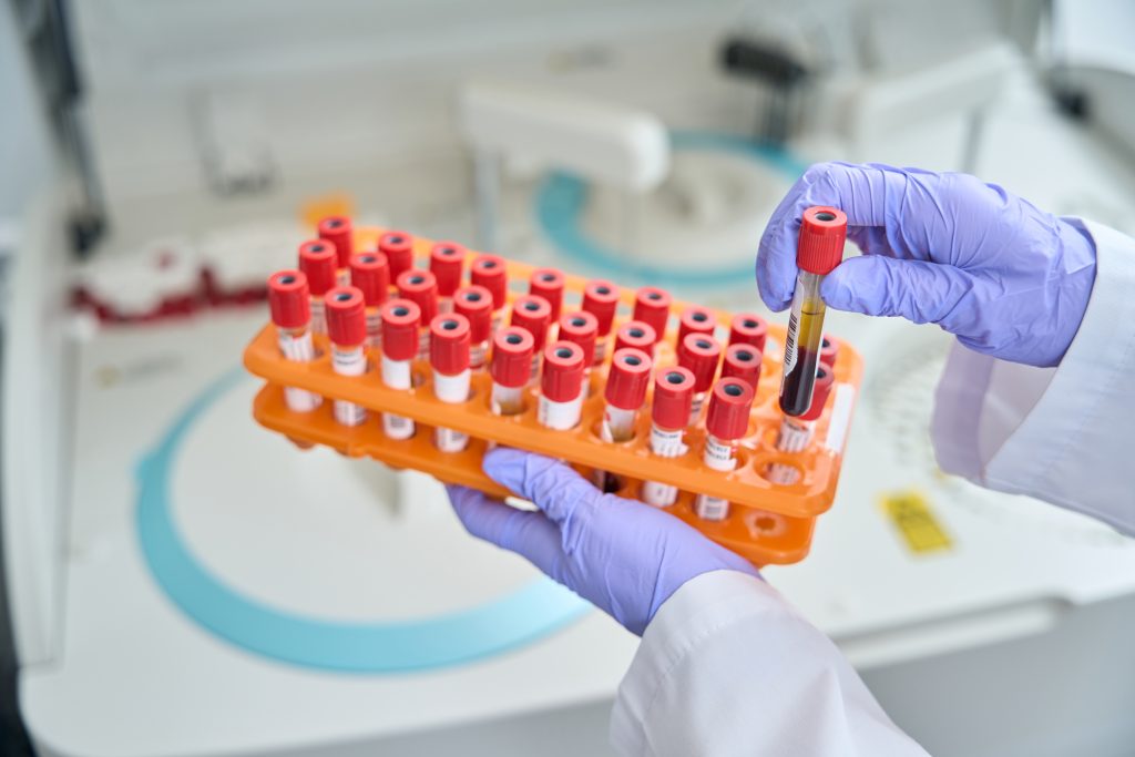 close up of doctor holding test tubes with blood i 2023 03 15 21 18 24 utc