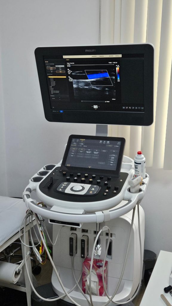 Dopplerul de carotidă: cum poți depista din timp riscul de accident vascular? 3 WhatsApp Image 2026 04 17 at 10.16.55